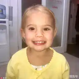 女童右眼失明致面部垮塌提取胃部脂肪造眼窝