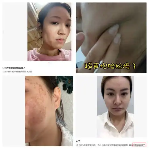 30岁普通女生如何低成本延缓衰老