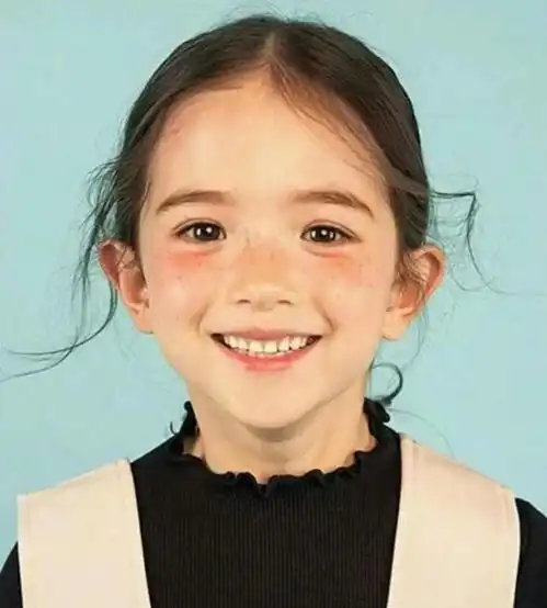 女性微信头像祛斑