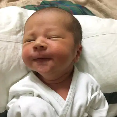 出生后十几天中不一样的本特利