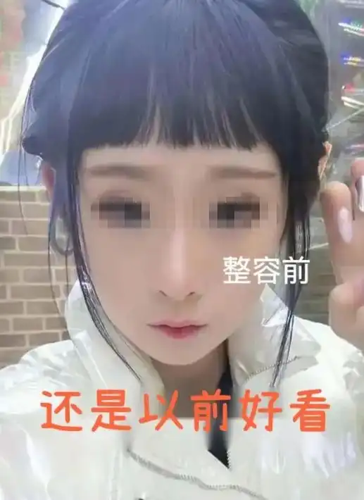 吉林女子整容后遭男友嫌弃分手哭泣,闺蜜见后懵了根本不敢看了