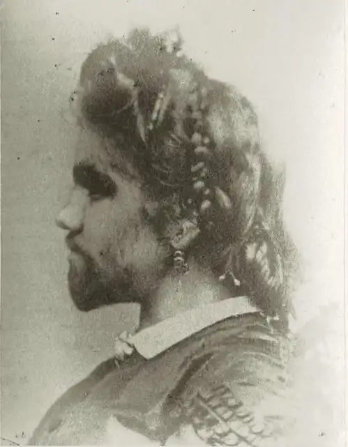 她是全球最丑女人,因身体特征显眼,被丈夫制成标本全世界展览