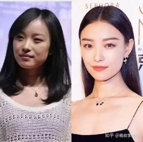 为什么大部分在廉价整容能被一眼看出来的情况下还有人可以去整