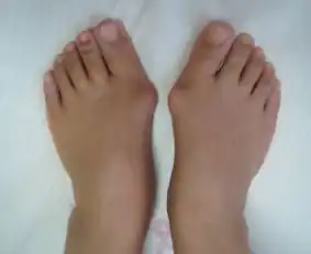 世上最丑的女人头像拇指