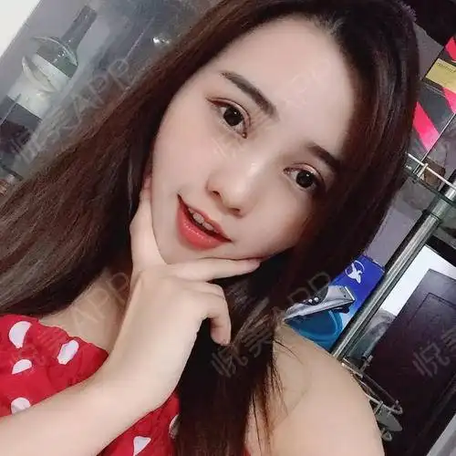 今日份水蜜桃女孩最近彻底迷上了刷抖音,小姐姐们都太...眼综合整形悦美整形