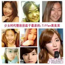 那些明星整容前的样子