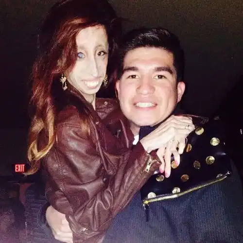 她被骂全世界最丑的女人,却教会千万人美是什么