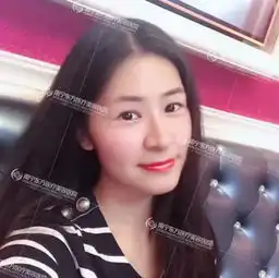 看这位美女做完下巴后4个月是什么样子的简直了