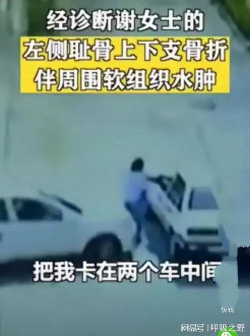 女子参加科目二考试被另外一辆考试车撞骨折
