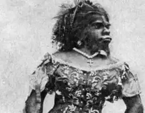 世界上最丑的女子,生前被丈夫当摇钱树,死后被丈夫制成标本展览