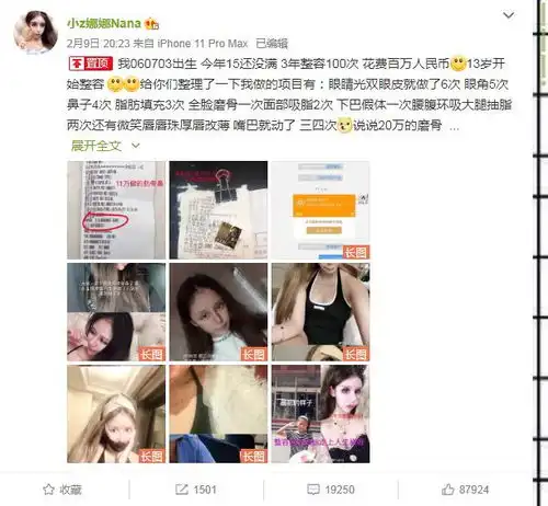 女孩13岁开始整容,3年整了60次花费百万,前后效果如同换头