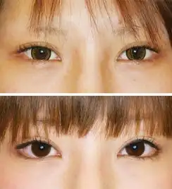为什么许多日本女星都有一双清纯可人的小鹿眼原来