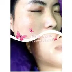 女士去斑面膜上海xy祛斑祛痘