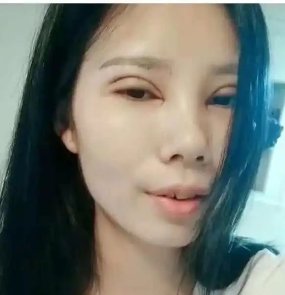 双眼皮美女火了,关掉美颜滤镜后,网友手术失败了
