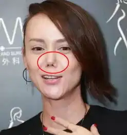 被整容毁掉的女星,张檬直言不后悔,而她却在手术台结束生命