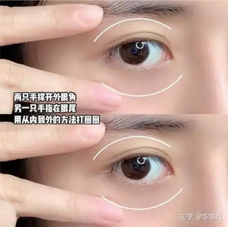有缓解天生黑眼圈的方法吗