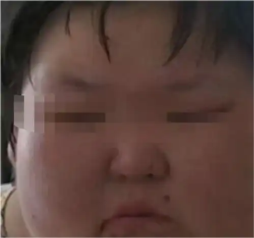 15岁女孩250斤,上学遭嘲笑,送医途中汽车轮胎被压爆,父母不是遗传