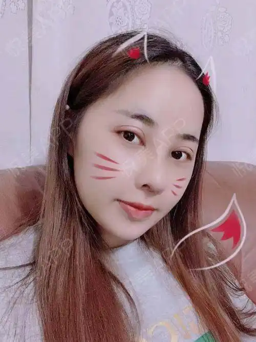 现在这个社会,对女孩子的要求总是那么的高,不仅要有...鼻部多项悦美整形