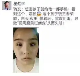 手机玩多了会瞎吗关于黄斑病变,这些谣言你不能信
