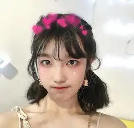 眼睛大了,变得囧囧有神,嘻嘻,真的很喜欢自己的眼睛...双眼皮悦美整形