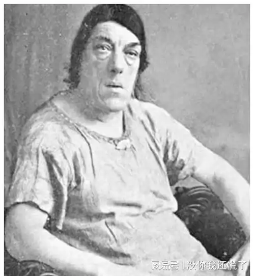 她被称为世上最丑的女人,却被富豪娶走,死后被制成标本供人欣赏