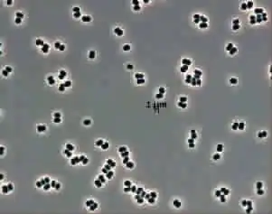 新疆活化石仙女虾霸气侧漏盘点你绝对没见过的稀有物种