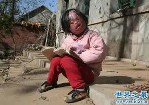世界上最丑陋的女人,世界上20个最丑的人怕吐勿看2