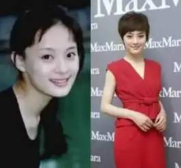 曝孙俪整容史,又一个天然假女