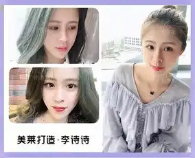 隆鼻后10天,从塌鼻素人变高冷女神