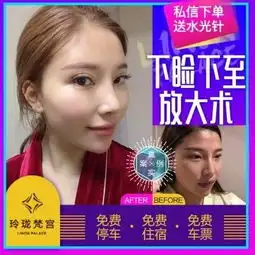 又来给大家更新日记了哟,最近都没有怎么去关注我的双...眼型矫正悦美整形