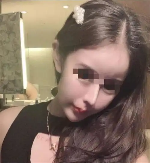 女孩13岁被亲妈支持去整容,花100万整60多次,如今画风一言难尽