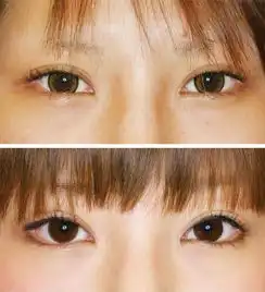 被吐槽这么久,韩国的女性为什么依然要整成同一张脸