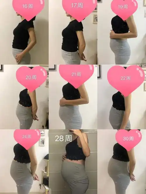 短肠综合征患者辅助受孕顺利生产,龙凤胎现满百日健康活泼