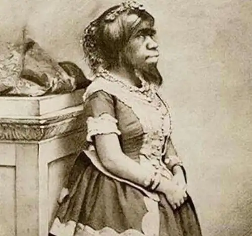 被称为最丑的女人高138㎝,一生被当成摇钱树,死后被制成标本