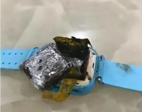 突发自燃,4岁女童被严重烧伤汉川很多小朋友都有...