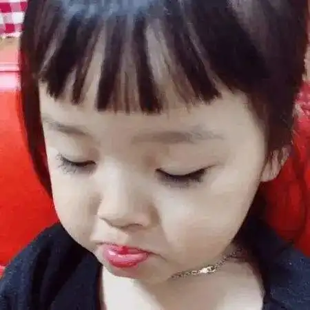 大专家选美莱只想要双眼皮为什么还要提肌会导致闭眼不全