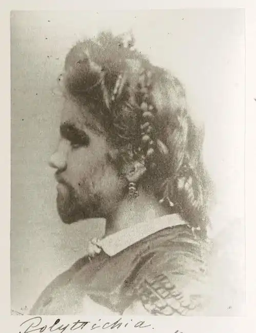 女子被鉴定为半人猿,却有20位男子向其示爱,死后变成标本仍抢手