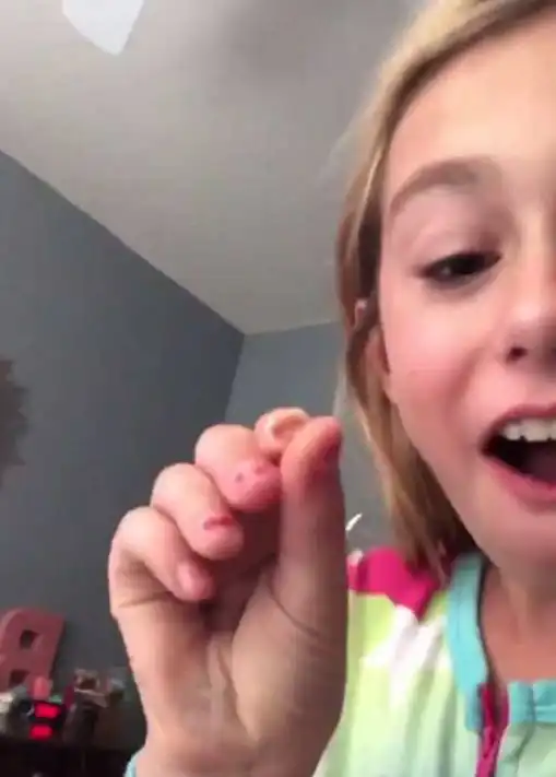 小萝莉的乳牙松动了,她让鹦鹉牙医帮忙取下来,鹦鹉小意思