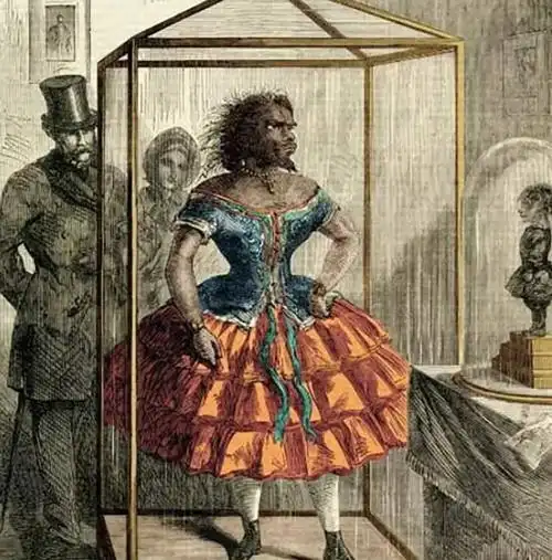 她是世界上最丑的女人,却有20多个求婚者,死后还被制成了标本