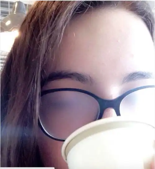 以前做近视手术的都后悔了,现在可能不要钱...