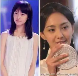 郑爽萧亚轩李多海大方承认整容的女星