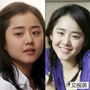 面部水肿阻事业学女星消肿变开运小v脸