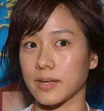 女星裸脸照10位女星皮肤糟糕图