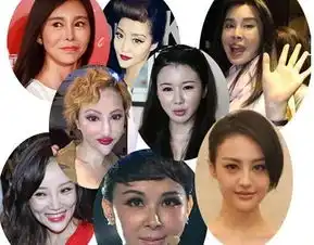 最不该整容的4个女星,莫小棋巩新亮最可惜,最后1个真心没救了
