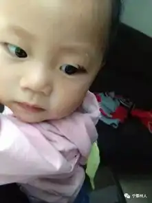 涉事幼儿园回复宁都20月大女童被咬伤左眼角事件
